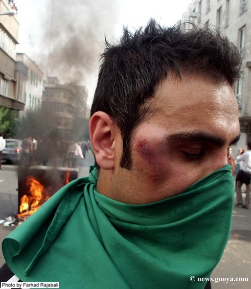 iran-protestor-bruised